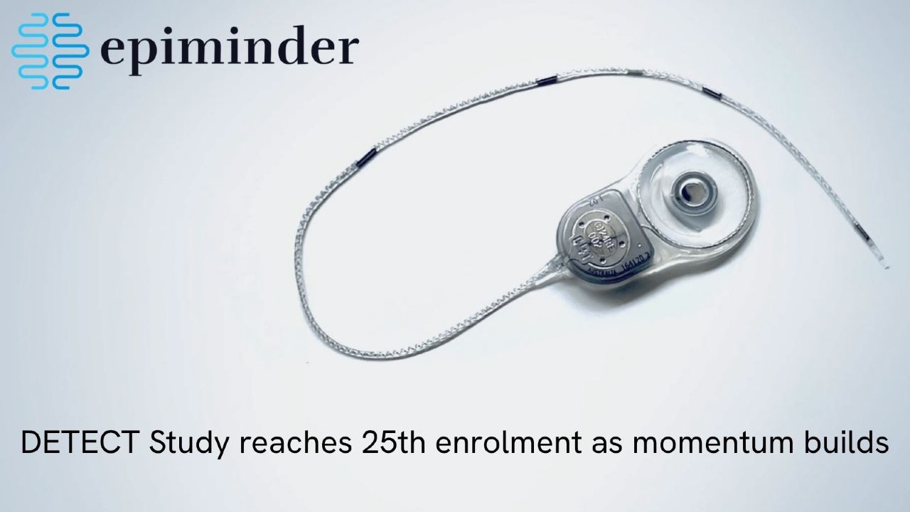 PRESS RELEASE: DETECT Study reaches 25th enrolment as momentum builds